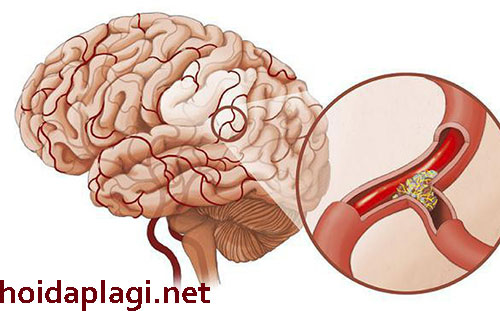 Phương Pháp Điều Trị Và Các Nối Sống Sinh Hoạt